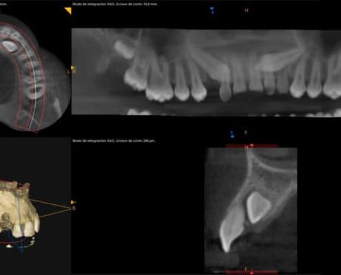 Escaner Dental Radiodiagnóstico 3D Panorámica
