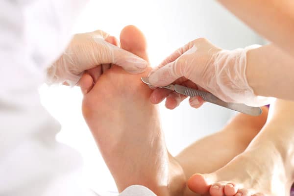 Cirugía del pie Podología